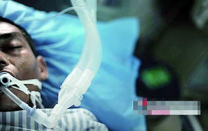 9月2日,湘潭市中心医院重症监护室,周道明嘴里插满了呼吸导管,医生说不马上手术他会有生命危险